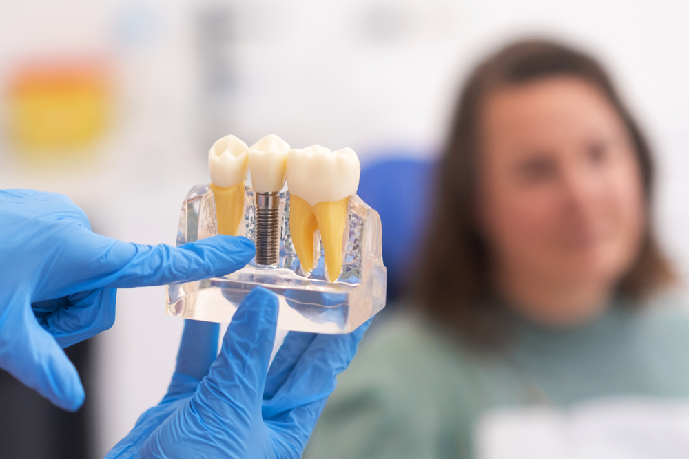 Understanding the Long-Term Value of All-on-4 Dental Implants